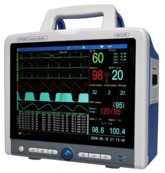 anestesia monitor